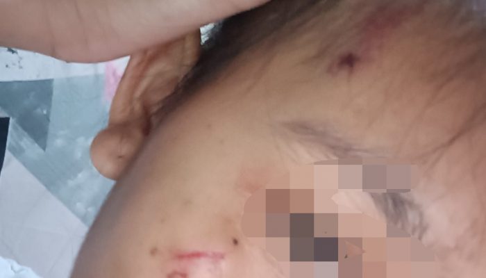 Istri Prajurit TNI di Depok Diduga Aniaya ART, Kening Ditusuk Pensil