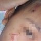 Istri Prajurit TNI di Depok Diduga Aniaya ART, Kening Ditusuk Pensil